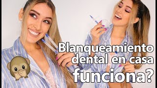 BLANQUEAMIENTO DENTAL PERÚ funciona duele cómo y dónde lo hago [upl. by Retxab]