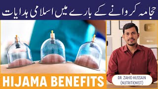 History Of Hijama In Islam  Hijama Ke Fayde  Hijama Benefits Urdu  Hijama Karne Ka Sunnat Tarika [upl. by Keung]