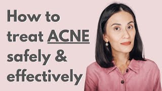 Safe and Effective Treatment for Mild to Moderate Acne  Dr Gaile RobredoVitas [upl. by Mackay]