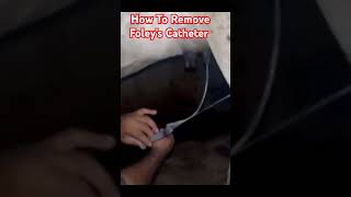 How To Remove Foleys Catheter Dr Hafiz Nadeem Ur Rehman vet viral shortsfeed [upl. by Belle]