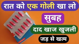 dad khaj khujali ki dava  बस 1 कैप्सूल से दाद खाज खुजली को जड़ से खत्म करे  dad khaj khujali [upl. by Oner]