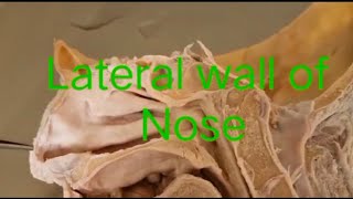 Lateral wall of nosedissection human [upl. by Dabbs]