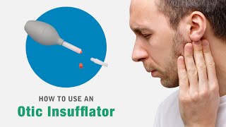 How to use an Otomed otic or ear insufflator device [upl. by Randal]