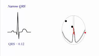 ECG QRS Complex [upl. by Hayouqes]