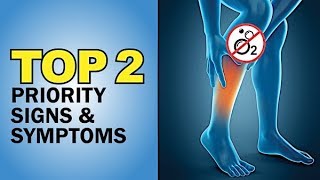 PAD Peripheral arterial disease 2 MOST important signs amp symptoms on Exams amp NCLEX [upl. by Zilada]