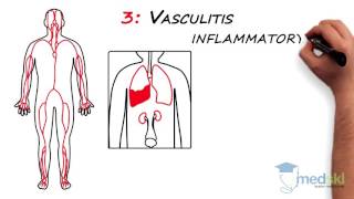 Rheumatology – Polyarticular Pain By Lori Albert MD [upl. by Nwaf]