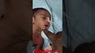 PREMATURE BABY NEWBORN newbornbaby viralshort cute critical [upl. by Weinstein897]