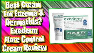 Best Cream For Eczema and Dermatitis Exederm Flare Control Cream Review  MumblesVideos Review [upl. by Petrick]