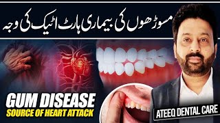 Gum Disease A Hidden Source of Heart Attack [upl. by Kcirtemed]