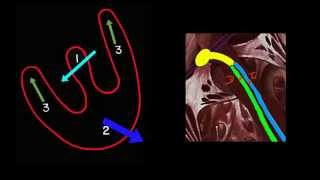 CURSO DE ELECTROCARDIOGRAFIA 43  BLOQUEO DE RAMA DERECHA [upl. by Katherina]