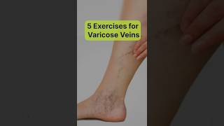 The Best Exercises for Varicose Vein Relief [upl. by Teillo]