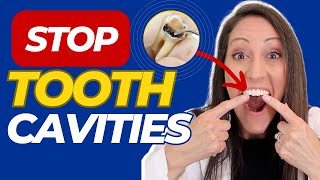 How to Prevent and Reverse Tooth Cavities amp Dental Disease  FREE Natural Cavity Remedy Download [upl. by Eronel]