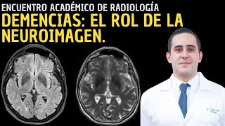 V Encuentro Académico de Radiología Demencias  El rol de la neuroimagen [upl. by Iad309]