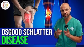 Osgood Schlatter Disease Treatment Options [upl. by Aihtnic]