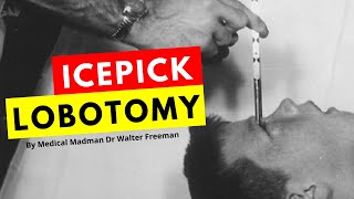 The Icepick Lobotomy by Dr Walter Freeman [upl. by Bevers]