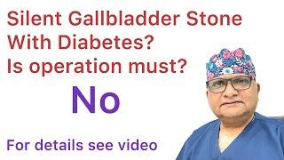 Diabetes and Gallbladder Stones Operation Treatment of Silent Gallbladder Stone in diabetic patient [upl. by Josie]