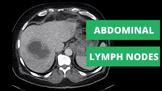 Abdominal CT Lymph Node Stations  How to read a CT [upl. by Ytirev]