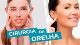 Cirurgia para corrigir a orelha em abano Tudo sobre otoplastia com Dr Lecy Marcondes [upl. by Ricoriki]