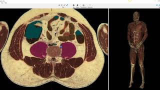 VH Dissector Pro Cross Sectional Anatomy of the Kidney Adrenal Ureter and Bladder [upl. by Gillespie953]