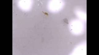 Copepods under a 200x Microscope [upl. by Aldarcy]