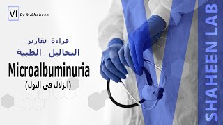 كيفية قراءة تحليل microalbuminuria [upl. by Ikir454]