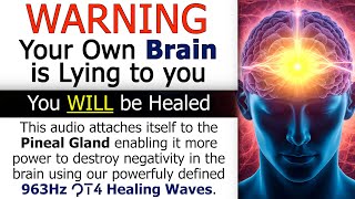 YOUR Pineal Gland DESTROYS Anxiety at 3 Mins YOUR OWN BRAIN DOES THE WORK  WE PROVIDE THE ABILITY [upl. by Hasseman]