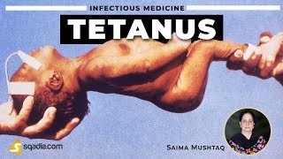 Tetanus  Definition  Infectious Medicine Video Lectures  VLearning [upl. by Aicnilav]