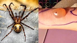 MOST Venomous Spiders On Earth [upl. by Goldman156]