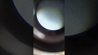 Semen analysis  semen test procedure  Sperm count [upl. by Ayahsal321]