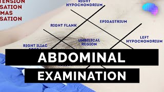 Abdominal Examination  OSCE Guide Latest  UKMLA  CPSA [upl. by Reba840]