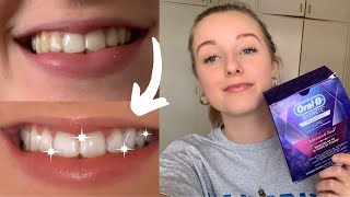 Oral B 3D White Whitestrips  Results Sensitivity [upl. by Shaylynn]