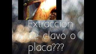 Extracción de clavo en fémur [upl. by Damien]