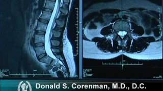 How to Read a MRI of the Normal Lumbar Spine  LowerBack  Vail Spine Specialist [upl. by Naux]