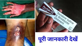 Povidone Iodine and Ornidazole Ointment Uses Or Side Effects in hindi [upl. by Pierce142]