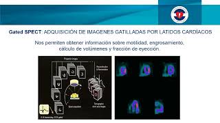 Estudios de Perfusión Miocárdica  SPECT [upl. by Marilin236]