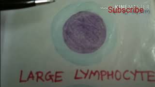 Small Lymphocytes and Large Lymphocytes [upl. by Akilam]