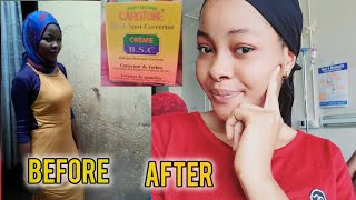 Extra whitening cream Carotone BSCwatch this before use [upl. by Acirrej]