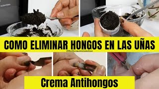 Crema Antihongos  Como Eliminar Hongos en las Uñas y en la Piel con Remedios Caseros [upl. by Nottage]