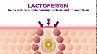 Know how Lactoferrrin helps lessen acne [upl. by Regazzi]