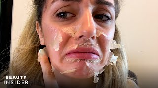 What It’s Like To Get A Chemical Peel For Acne Scars  Beauty Explorers  Beauty Insider [upl. by Ennalorac484]