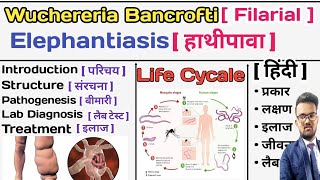 Wuchereria Bancrofti  Filarial Worm  Elephantiasis  हाथीपावा  Parasitology Notes  Microbiology [upl. by Ylas]