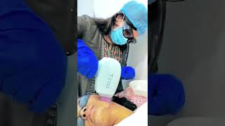 Laser Hair Reduction Treatment [upl. by Ahcire]