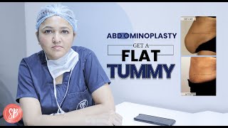 Abdominoplasty  Tummy Tuck in Delhi and Gurgaon by Shilpi Bhadani  Best Plastic Surgeon India [upl. by Hsara]