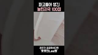 발톱 파고들어 생긴 눌린자국 shorts 풋풋한리쌤 발톱관리전문점 [upl. by Gui577]