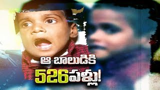 526 teeth removed from a 7yearold boy’s jaw in Chennai [upl. by Welford]