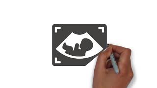 AMNIOCENTESIS  MATERNAL HEALTH  PRENATAL TESTING [upl. by Aihtebat326]