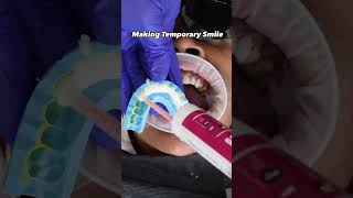 Making temporary smile dentist dentistry dentalcare shorts [upl. by Eniahpets]