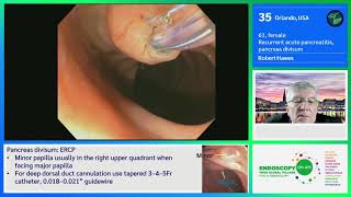 EOA 2020 Case 28 ERCP pancreas divisum Hawes [upl. by Nylidnarb]