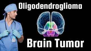 Brain Tumor  Oligodendroglioma Detailed info about diagnosis survival etc [upl. by Aneelahs577]