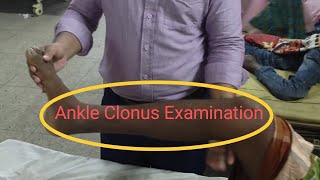 Ankle Clonus Examination [upl. by Eetsirk]